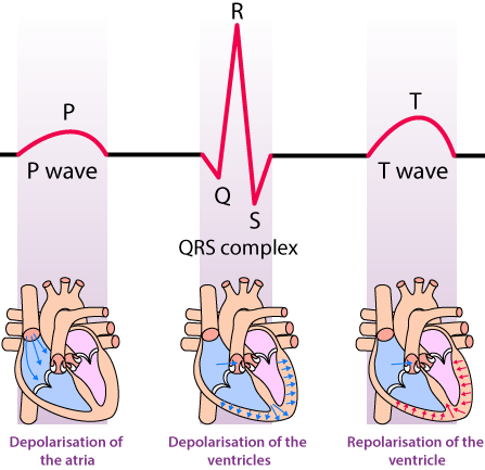 Décomposition des ondes P, QRS et T de l'ECG