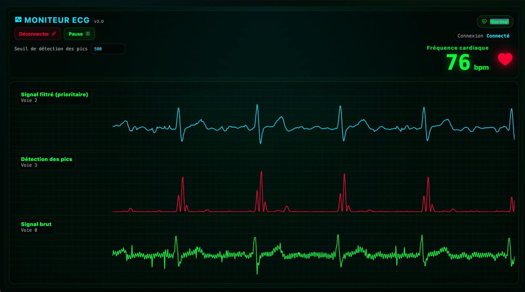 Moniteur ECG web temps réel